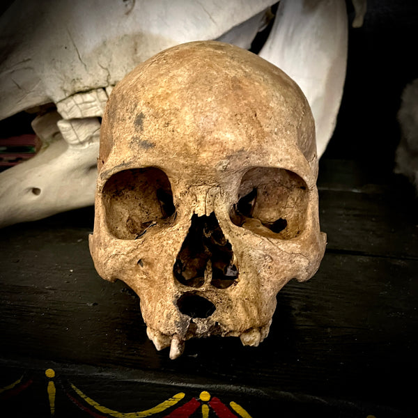 Human skull