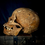 Item 11. Human skull with mandible