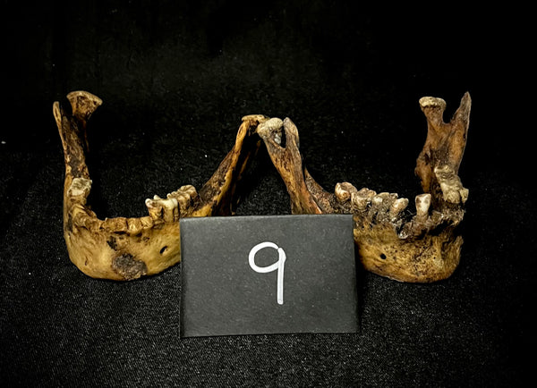 Item 9. Two human mandibles