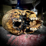 Human skull