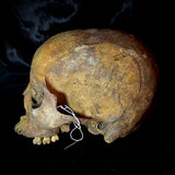 Item 18. Human skull