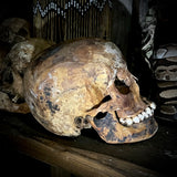 Human skull with mandible