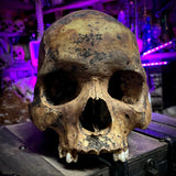 Human skull