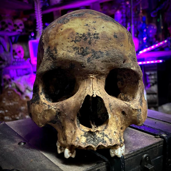 Human skull