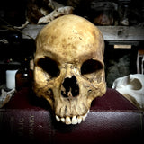 Human skull