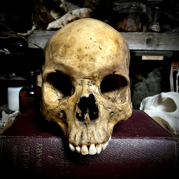 Human skull