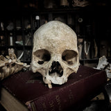 Human skull