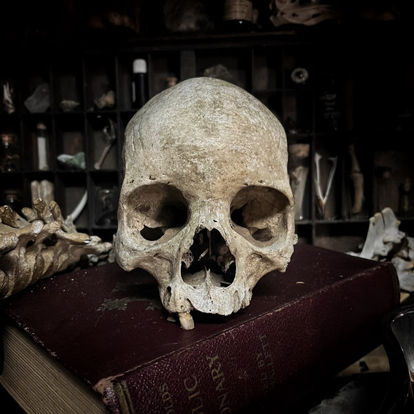 Human skull