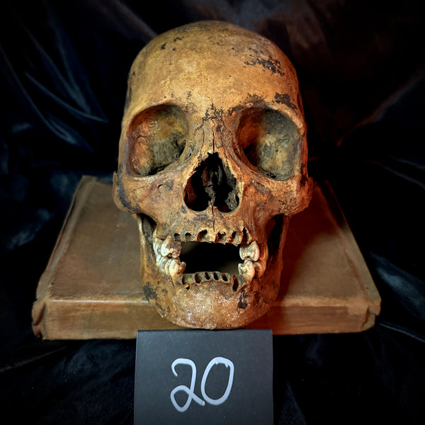 Item 20. Human skull with mandible