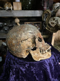 Human skull