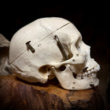Medically prepared human skull