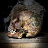 Human skull with mandible