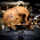 Human skull