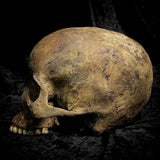 Human skull