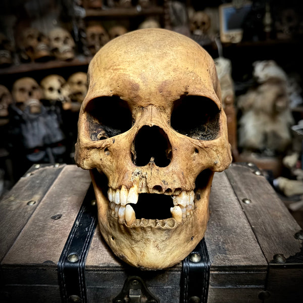 Human skull with mandible