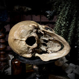 A human medical skull