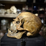 Human medical skull