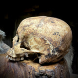 Human skull