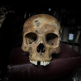 Human skull