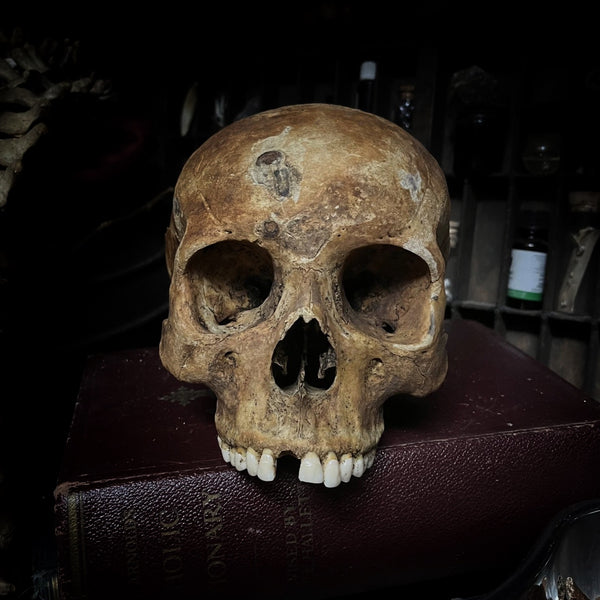 Human skull