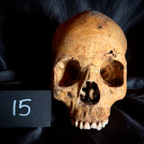 Item 15. Human skull