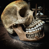 Human skull