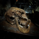 Human skull
