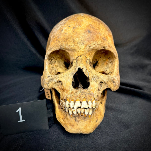 Item 1. Human skull with mandible