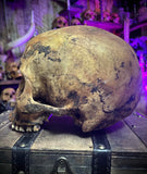 Human skull