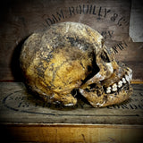 Human skull with mandible