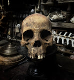 Human skull