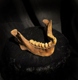 A mandible