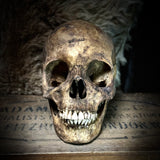Human skull with mandible