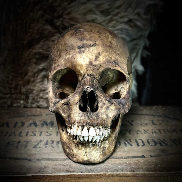 Human skull with mandible