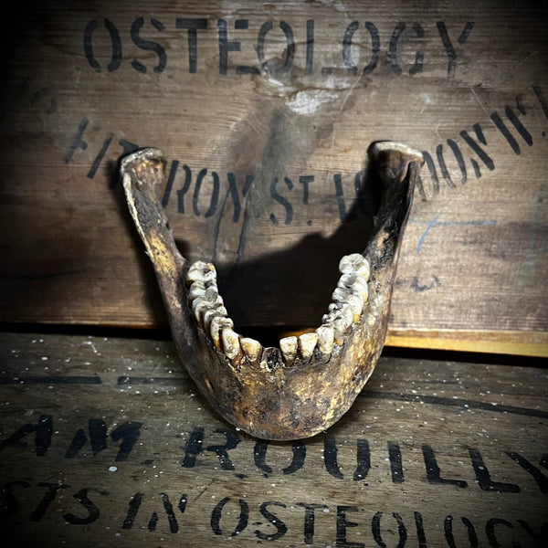 A mandible