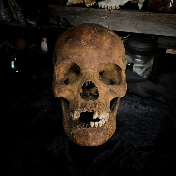 Human skull