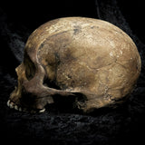 Human skull