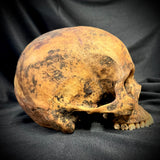 Item 11. Human skull