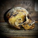 Human skull with mandible