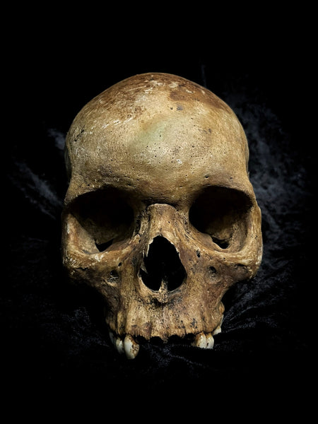 Human skull
