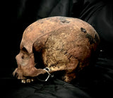 A human skull