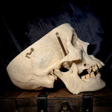 Item 5. Human medical skull