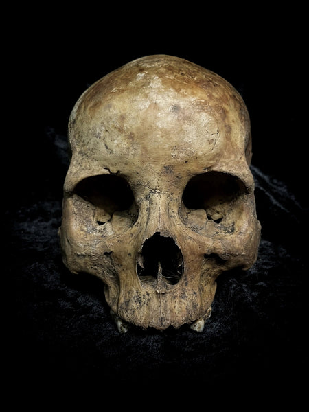 Human skull