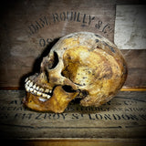 Human skull with mandible