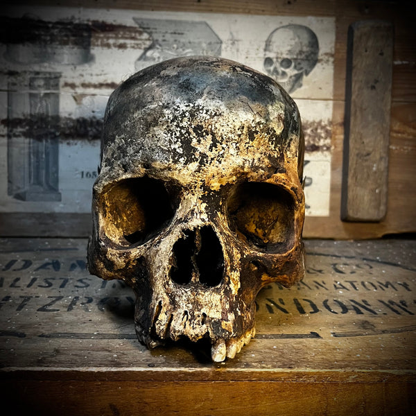 Human skull