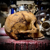 Human skull