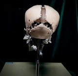 Adam Rouilly Exploded skull