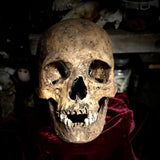 A human skull with mandible