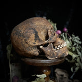 A human skull with mandible