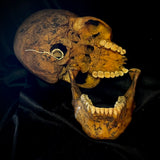 Item 9. Human skull with mandible